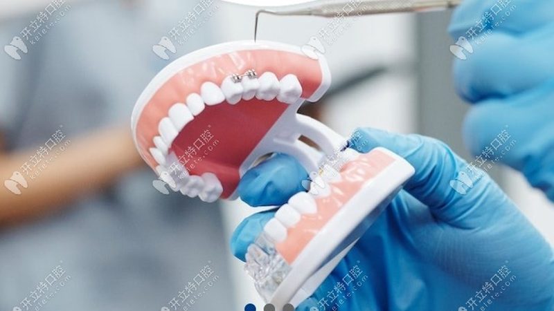 牙齿美白牙膏如何选择？揭秘有效成分与误区**
