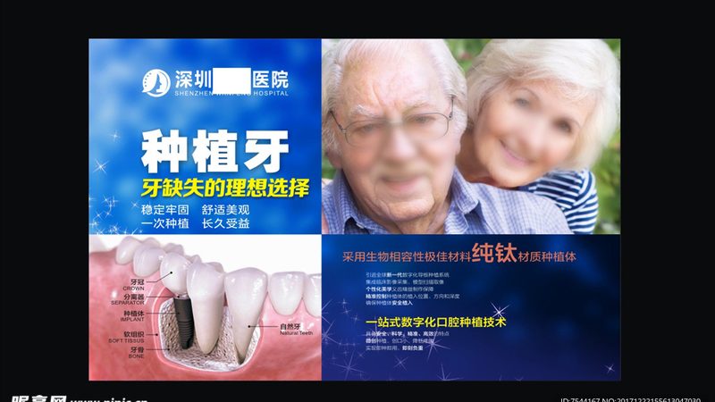 全瓷牙，牙科美容的时尚之选